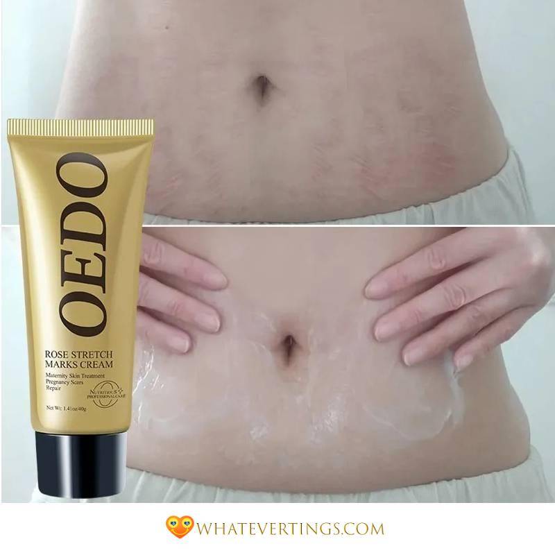Stretch Mark Cream Health & Beauty Ships From : China|United States|Russian Federation 
